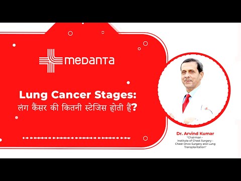  Lung Cancer Stages: लंग कैंसर की कितनी स्टेजिस होती हैं? 